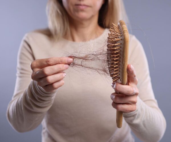 GLP-1 Affected Hair Loss